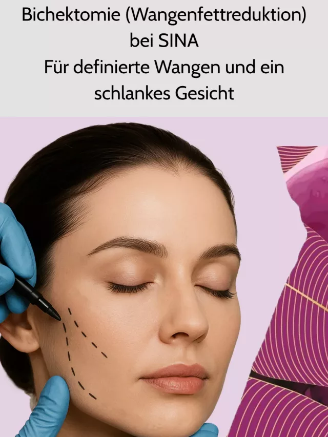 Augenbrauenlifting bei SINA Für eine harmonische Gesichtsästhetik (2)